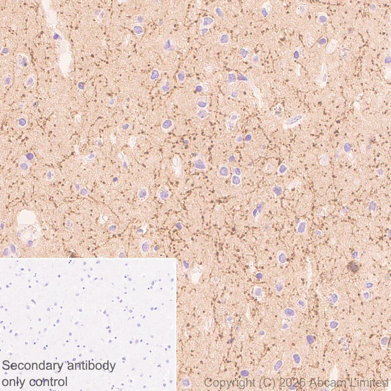 Immunohistochemistry (Formalin/PFA-fixed paraffin-embedded sections) - Anti-Cannabinoid Receptor I antibody [EPR30843-34] (AB325797)