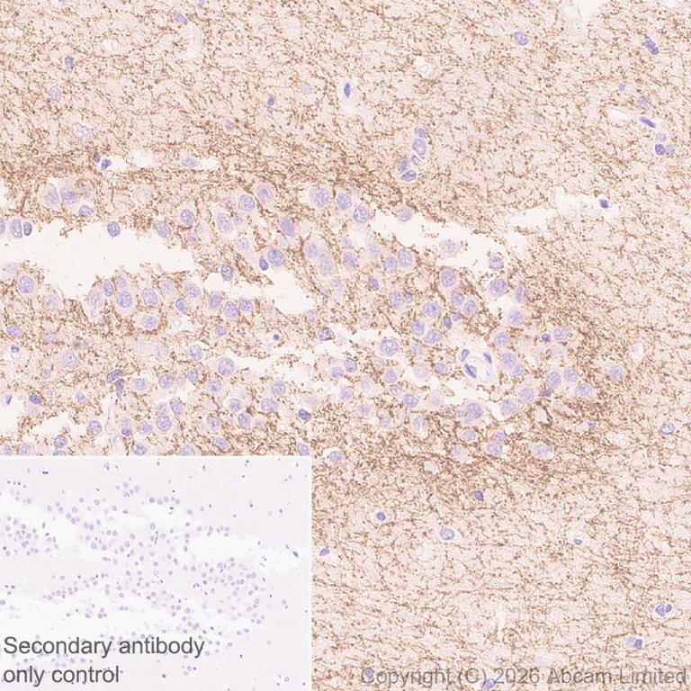 Immunohistochemistry (Formalin/PFA-fixed paraffin-embedded sections) - Anti-Cannabinoid Receptor I antibody [EPR30843-34] (AB325797)