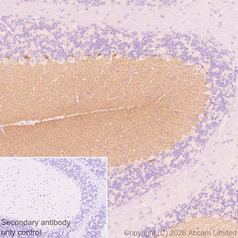 Immunohistochemistry (Formalin/PFA-fixed paraffin-embedded sections) - Anti-Cannabinoid Receptor I antibody [EPR30843-34] (AB325797)