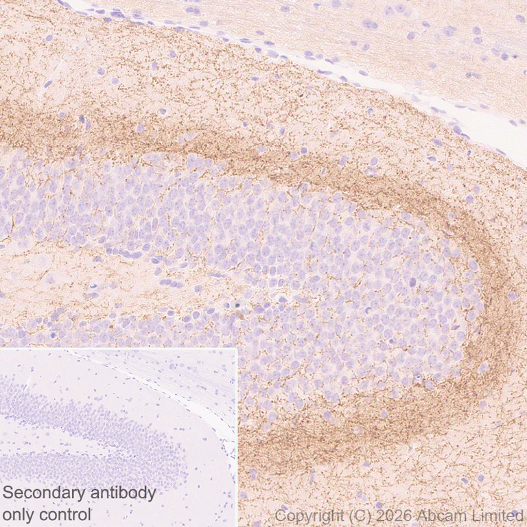 Immunohistochemistry (Formalin/PFA-fixed paraffin-embedded sections) - Anti-Cannabinoid Receptor I antibody [EPR30843-34] (AB325797)