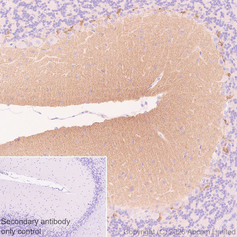 Immunohistochemistry (Formalin/PFA-fixed paraffin-embedded sections) - Anti-Cannabinoid Receptor I antibody [EPR30843-34] (AB325797)