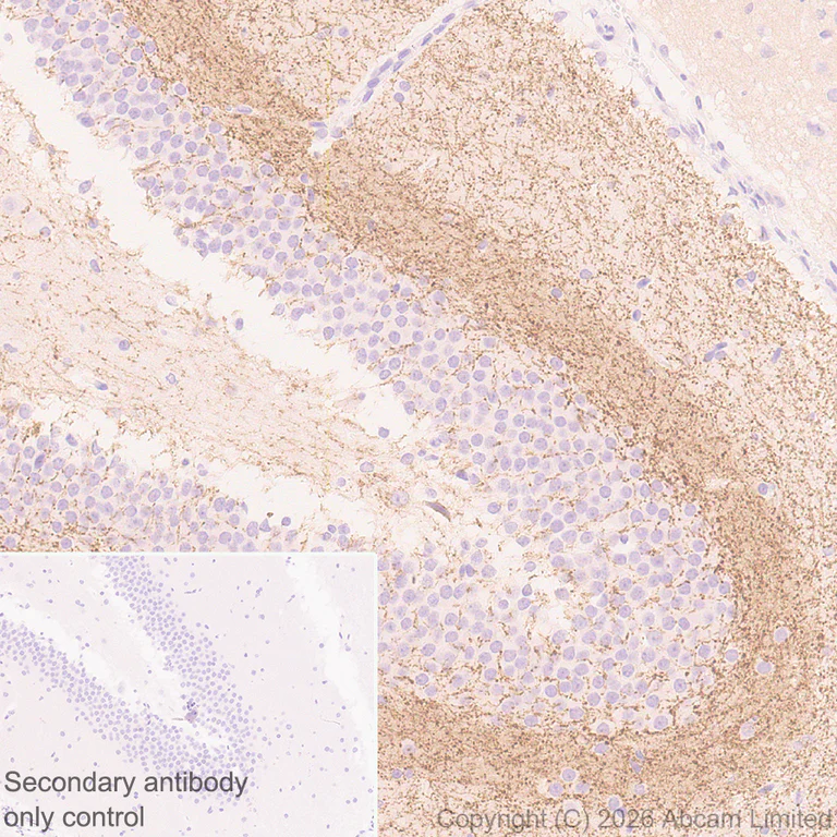 Immunohistochemistry (Formalin/PFA-fixed paraffin-embedded sections) - Anti-Cannabinoid Receptor I antibody [EPR30843-34] (AB325797)