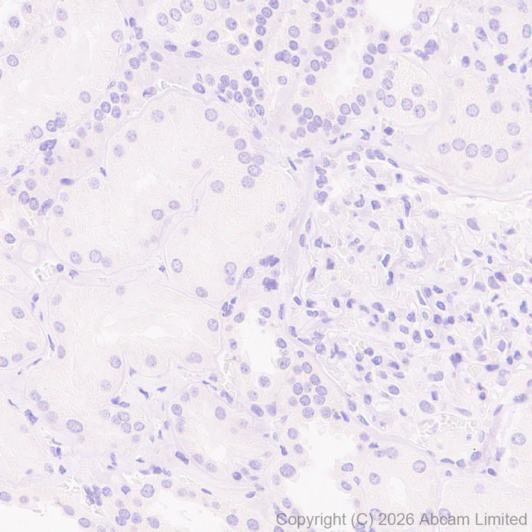 Immunohistochemistry (Formalin/PFA-fixed paraffin-embedded sections) - Anti-Cannabinoid Receptor I antibody [EPR30843-34] (AB325797)