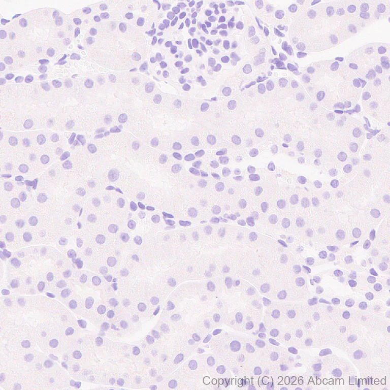 Immunohistochemistry (Formalin/PFA-fixed paraffin-embedded sections) - Anti-Cannabinoid Receptor I antibody [EPR30843-34] (AB325797)
