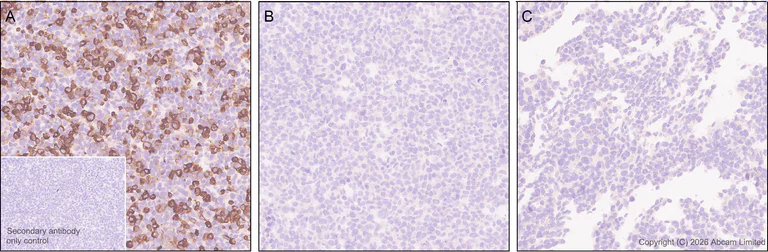 Immunohistochemistry (Formalin/PFA-fixed paraffin-embedded sections) - Anti-Cannabinoid Receptor I antibody [EPR30843-34] (AB325797)