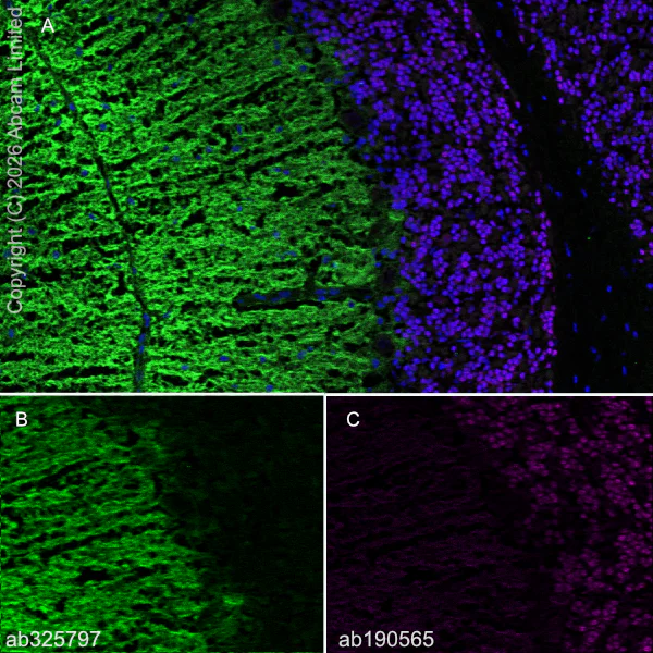 Immunohistochemistry (Frozen sections) - Anti-Cannabinoid Receptor I antibody [EPR30843-34] (AB325797)