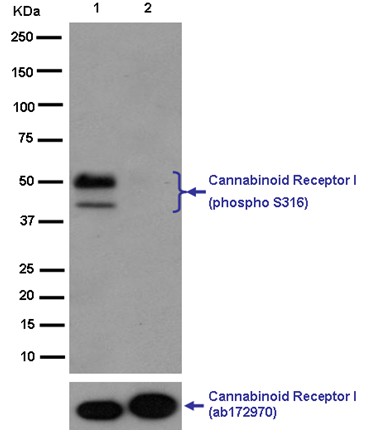 Western blot - Anti-Cannabinoid Receptor I (phospho S316) antibody [EPR2223(N)] (AB186428), expandable thumbnail