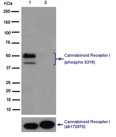 Western blot - Anti-Cannabinoid Receptor I (phospho S316) antibody [EPR2223(N)] (AB186428)