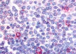 Immunohistochemistry (Formalin/PFA-fixed paraffin-embedded sections) - Anti-Cannabinoid Receptor II antibody (AB150569)