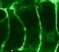 Immunocytochemistry - Anti-Cannabinoid Receptor II antibody (AB3561)
