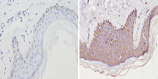 Immunohistochemistry (Formalin/PFA-fixed paraffin-embedded sections) - Anti-Cannabinoid Receptor II antibody (AB3561), expandable thumbnail
