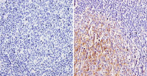 Immunohistochemistry (Formalin/PFA-fixed paraffin-embedded sections) - Anti-Cannabinoid Receptor II antibody (AB3561)
