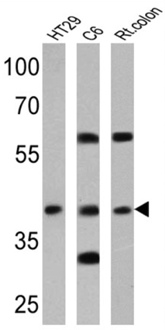 Western blot - Anti-Cannabinoid Receptor II antibody (AB3561), expandable thumbnail
