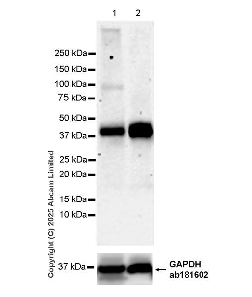 Western blot - Anti-CANT1 antibody [EPR29983-518] (AB323618), expandable thumbnail