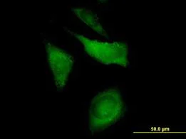 Immunocytochemistry/ Immunofluorescence - Anti-CAP1 antibody (AB88446)