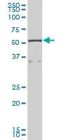 Western blot - Anti-CAP1 antibody (AB88446)