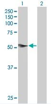 Western blot - Anti-CAP1 antibody (AB88446)