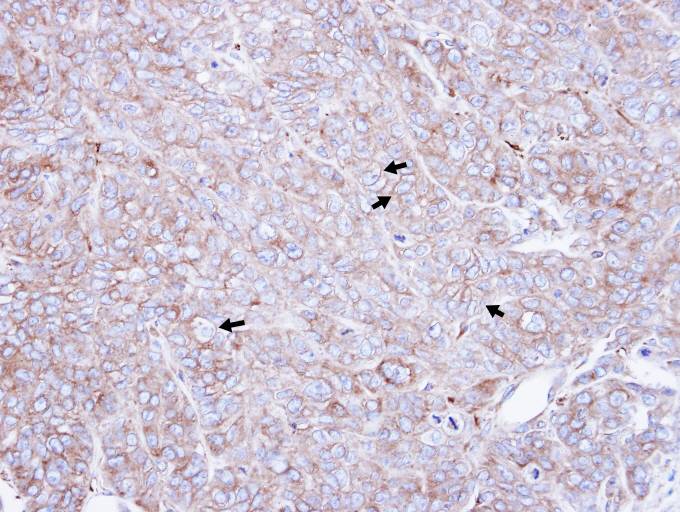 Immunohistochemistry (Formalin/PFA-fixed paraffin-embedded sections) - Anti-CAP1 antibody (AB96354)