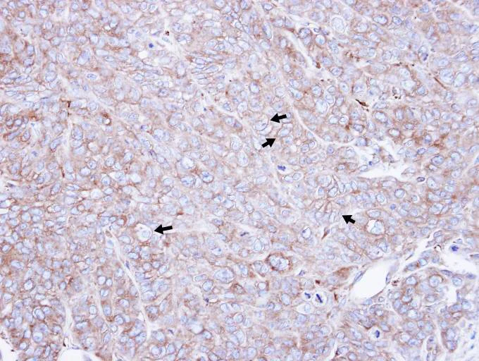 Immunohistochemistry (Formalin/PFA-fixed paraffin-embedded sections) - Anti-CAP1 antibody (AB96354)