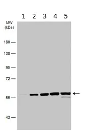 Western blot - Anti-CAP1 antibody (AB96354)