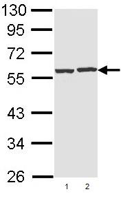 Western blot - Anti-CAP1 antibody (AB96354)