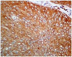 Immunohistochemistry (Formalin/PFA-fixed paraffin-embedded sections) - Anti-CAP1 antibody [EPR8338] (AB133655)
