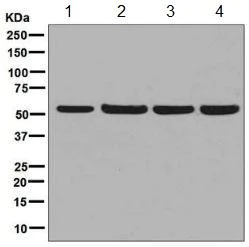 Western blot - Anti-CAP1 antibody [EPR8338] (AB133655)