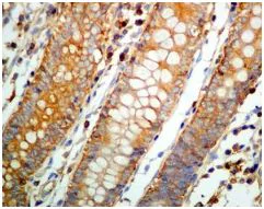 Immunohistochemistry (Formalin/PFA-fixed paraffin-embedded sections) - Anti-CAP1 antibody [EPR8338] - BSA and Azide free (AB232037)