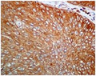 Immunohistochemistry (Formalin/PFA-fixed paraffin-embedded sections) - Anti-CAP1 antibody [EPR8338] - BSA and Azide free (AB232037), expandable thumbnail