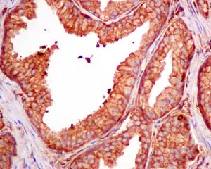 Anti-CAP1 antibody [EPR8339(B)]