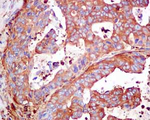 Immunohistochemistry (Formalin/PFA-fixed paraffin-embedded sections) - Anti-CAP1 antibody [EPR8339(B)] (AB155079)