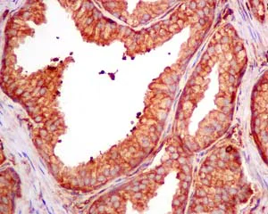 Immunohistochemistry (Formalin/PFA-fixed paraffin-embedded sections) - Anti-CAP1 antibody [EPR8339(B)] - BSA and Azide free (AB249174)