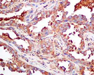 Immunohistochemistry (Formalin/PFA-fixed paraffin-embedded sections) - Anti-CAP1 antibody [EPR8339(B)] - BSA and Azide free (AB249174)