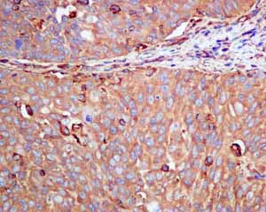 Immunohistochemistry (Formalin/PFA-fixed paraffin-embedded sections) - Anti-CAP1 antibody [EPR8339(B)] - BSA and Azide free (AB249174)