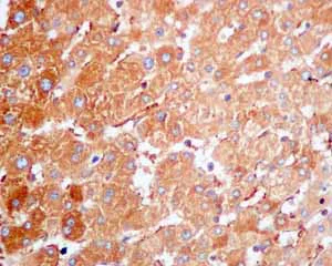 Immunohistochemistry (Formalin/PFA-fixed paraffin-embedded sections) - Anti-CAP1 antibody [EPR8339(B)] - BSA and Azide free (AB249174)