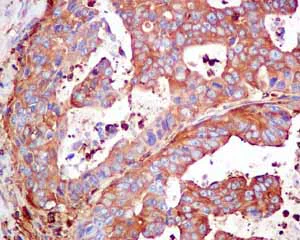 Immunohistochemistry (Formalin/PFA-fixed paraffin-embedded sections) - Anti-CAP1 antibody [EPR8339(B)] - BSA and Azide free (AB249174)