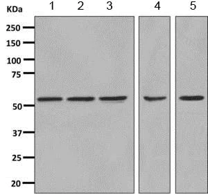 Western blot - Anti-CAP1 antibody [EPR8339(B)] - BSA and Azide free (AB249174)
