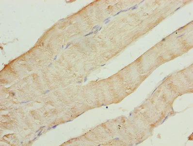 Immunohistochemistry (Formalin/PFA-fixed paraffin-embedded sections) - Anti-CAP2 antibody (AB236590)