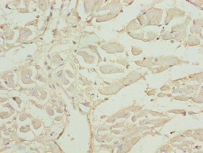 Immunohistochemistry (Formalin/PFA-fixed paraffin-embedded sections) - Anti-CAP2 antibody (AB236590)