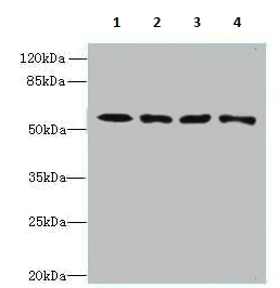 Western blot - Anti-CAP2 antibody (AB236590)