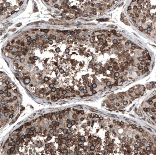 Immunohistochemistry (Formalin/PFA-fixed paraffin-embedded sections) - Anti-Caprin-1 antibody (AB244360)
