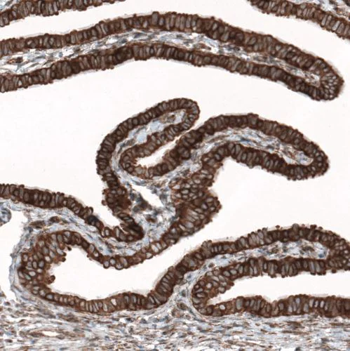 Immunohistochemistry (Formalin/PFA-fixed paraffin-embedded sections) - Anti-Caprin-1 antibody (AB244360)