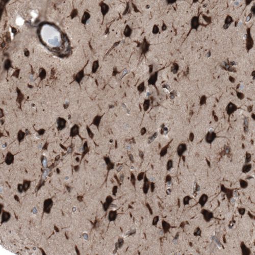 Immunohistochemistry (Formalin/PFA-fixed paraffin-embedded sections) - Anti-Caprin-1 antibody (AB244360)