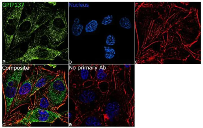 Immunocytochemistry/ Immunofluorescence - Anti-Caprin-1 antibody [RP23040261] (AB313547)