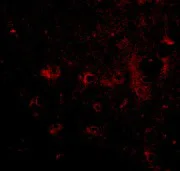 Immunocytochemistry/ Immunofluorescence - Anti-CAPS2 antibody (AB69794)