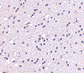 Immunohistochemistry (Formalin/PFA-fixed paraffin-embedded sections) - Anti-CAPS2 antibody (AB69794)