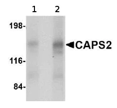 Western blot - Anti-CAPS2 antibody (AB69794)