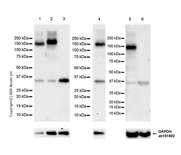 Western blot - Anti-CAPS2 antibody [EPR27004-72] - BSA and Azide free (AB307725), expandable thumbnail
