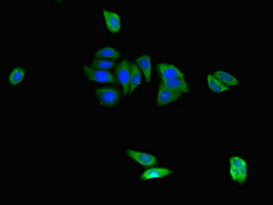 Immunocytochemistry/ Immunofluorescence - Anti-CAPZA1 antibody (AB234836)