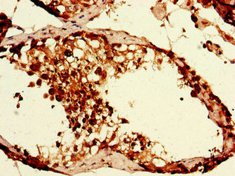 Immunohistochemistry (Formalin/PFA-fixed paraffin-embedded sections) - Anti-CAPZA1 antibody (AB234836)